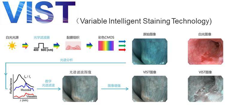 国内彩超代表企业对医疗设备的影响——开立医疗(仁成医疗维修)