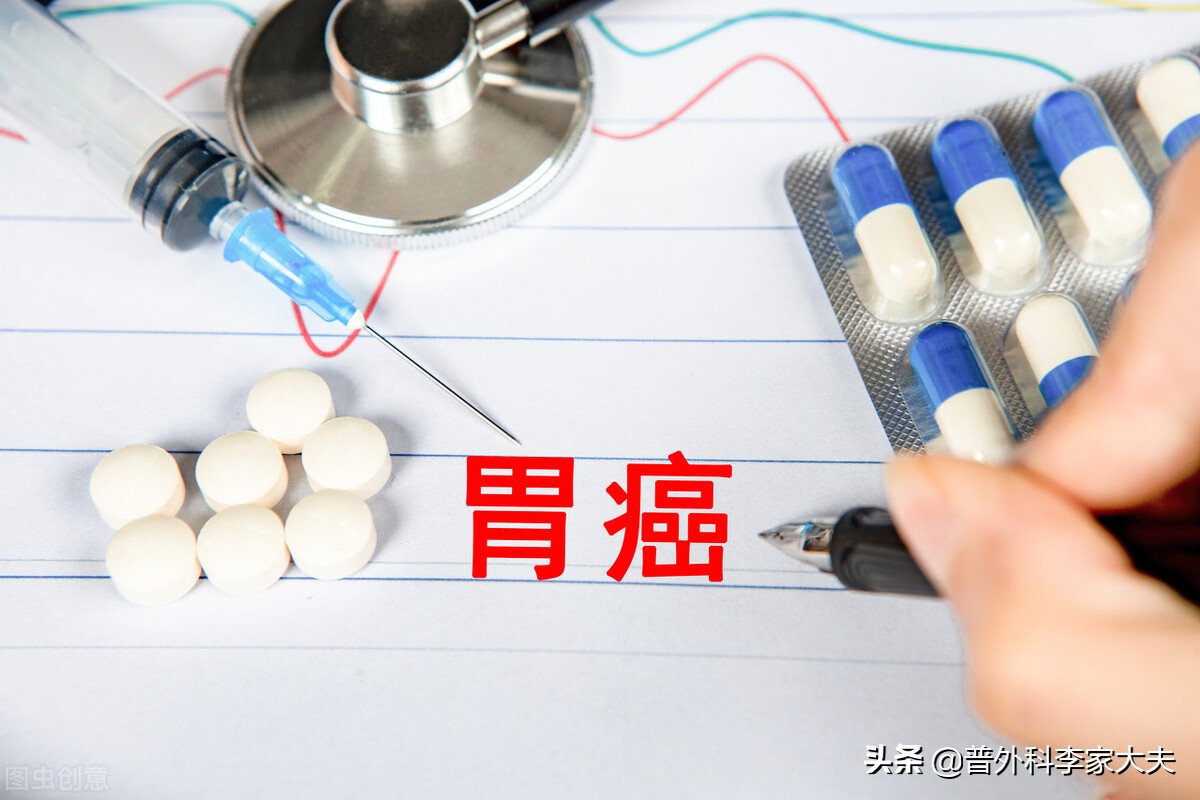 不能切除的晚期胃癌能活多久,胃癌患者可行胃癌根治术