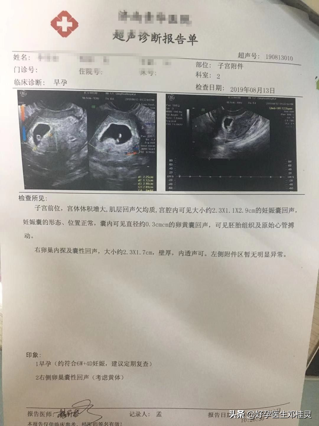 多囊促排子宫有息肉怎么办,多囊宫腔有息肉