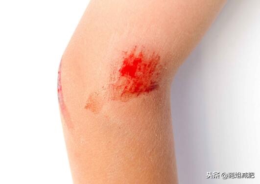 这六种伤口容易感染破伤风,容易感染破伤风的伤口有哪些特征