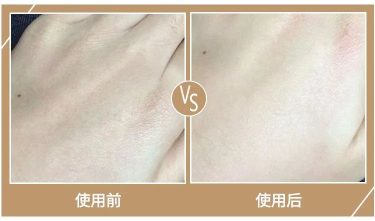 妮娜泰勒是谁,妮娜泰勒的手