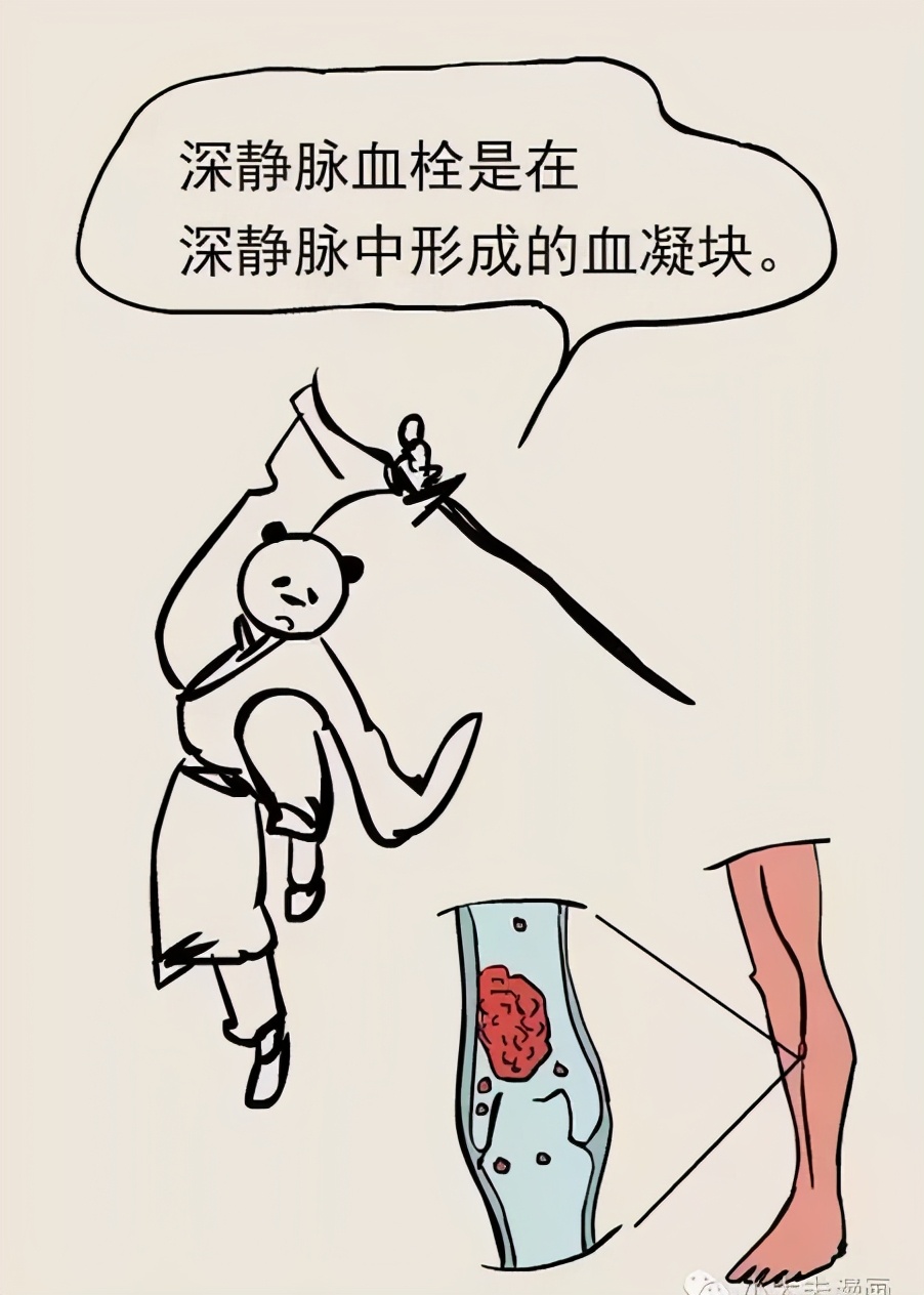 孕期血栓栓塞如何预防,孕妇需知揭秘产科杀手羊水栓塞