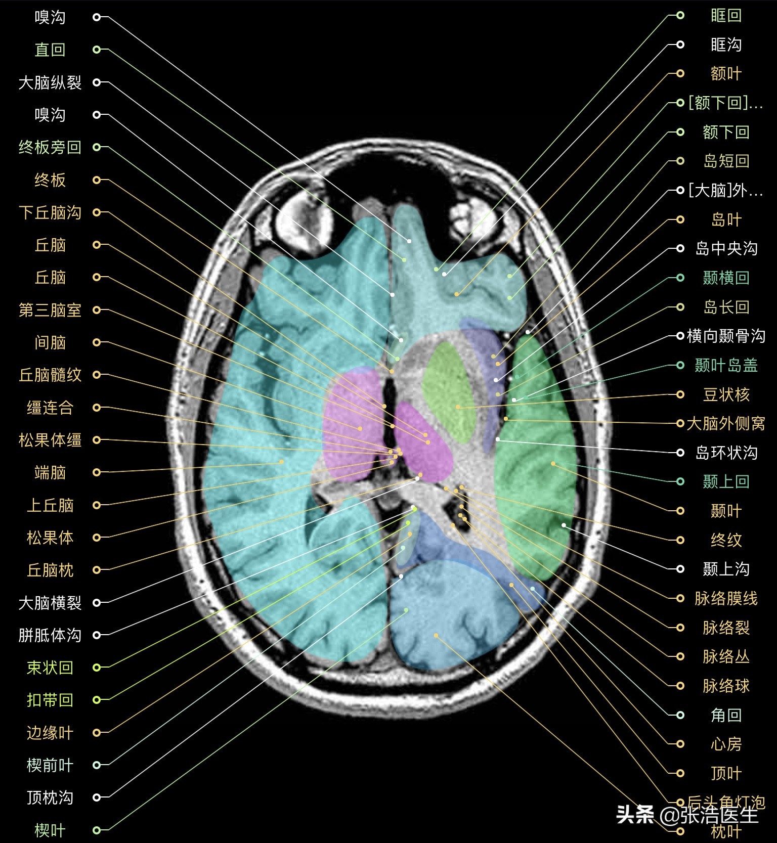 颅脑mri解剖影像检查是什么意思,颅脑mri断层解剖视频课件