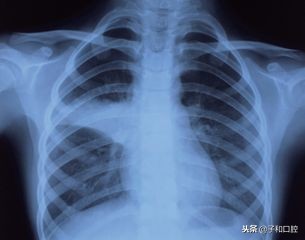 孩子口臭是否是积食了,孩子口臭分析