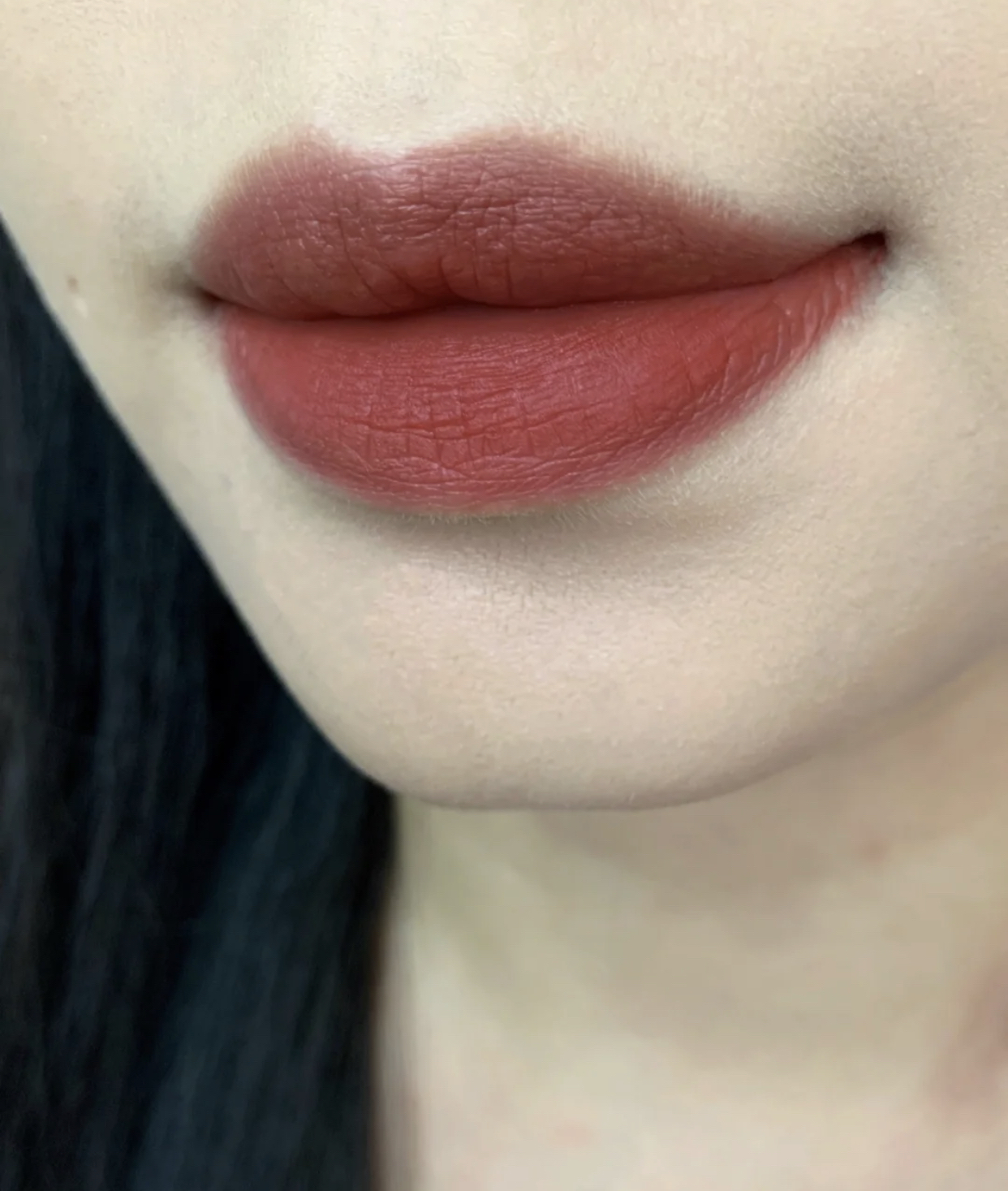 嘴唇经常又干又起皮是什么原因,嘴唇黑紫起干皮用什么