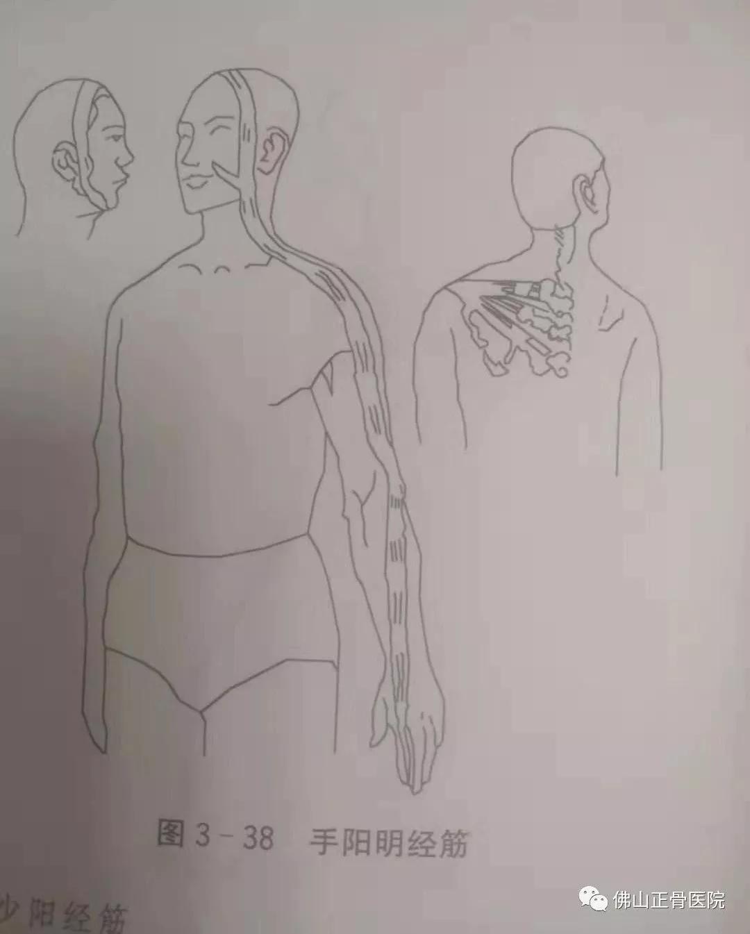 经筋手法，我院名誉院长国医大师韦贵康《韦氏骨伤手法集成》
