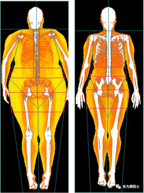糖尿病通过运动减肥可以逆转吗,糖尿病可以通过吃中药来逆转吗