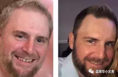 有治疗甲状腺癌特效药吗,治疗甲状腺癌最好中医