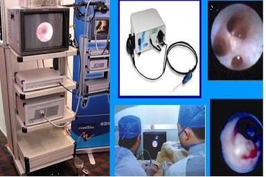 乳头溢液4年会得乳腺癌吗,乳头溢液可能是乳腺癌吗