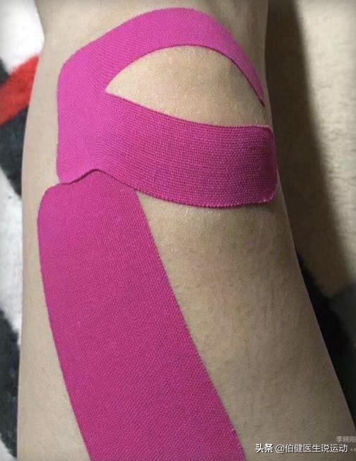 髌骨软化症有没有办法消除炎症,髌骨软化髌骨关节炎怎么治疗