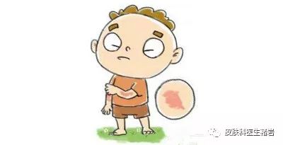 湿疹性皮炎长什么样,脸上湿疹长什么样