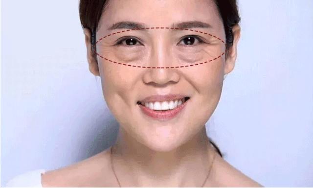 眼袋大显老试试这个方法简单实用,眼袋显老怎么办四种方法帮你去掉