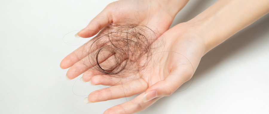 女性大量脱发什么原因,女性脱发的原因及解决方法