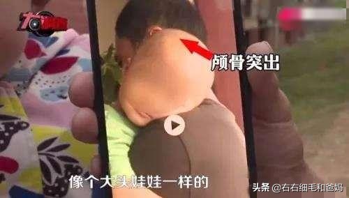 过敏宝宝选奶粉看什么科,过敏的孩子怎么选择特殊配方奶粉