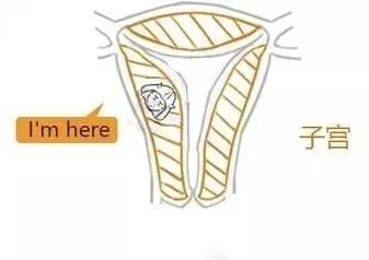 子宫肌瘤动漫演示,子宫肌瘤是什么原因导致的漫画