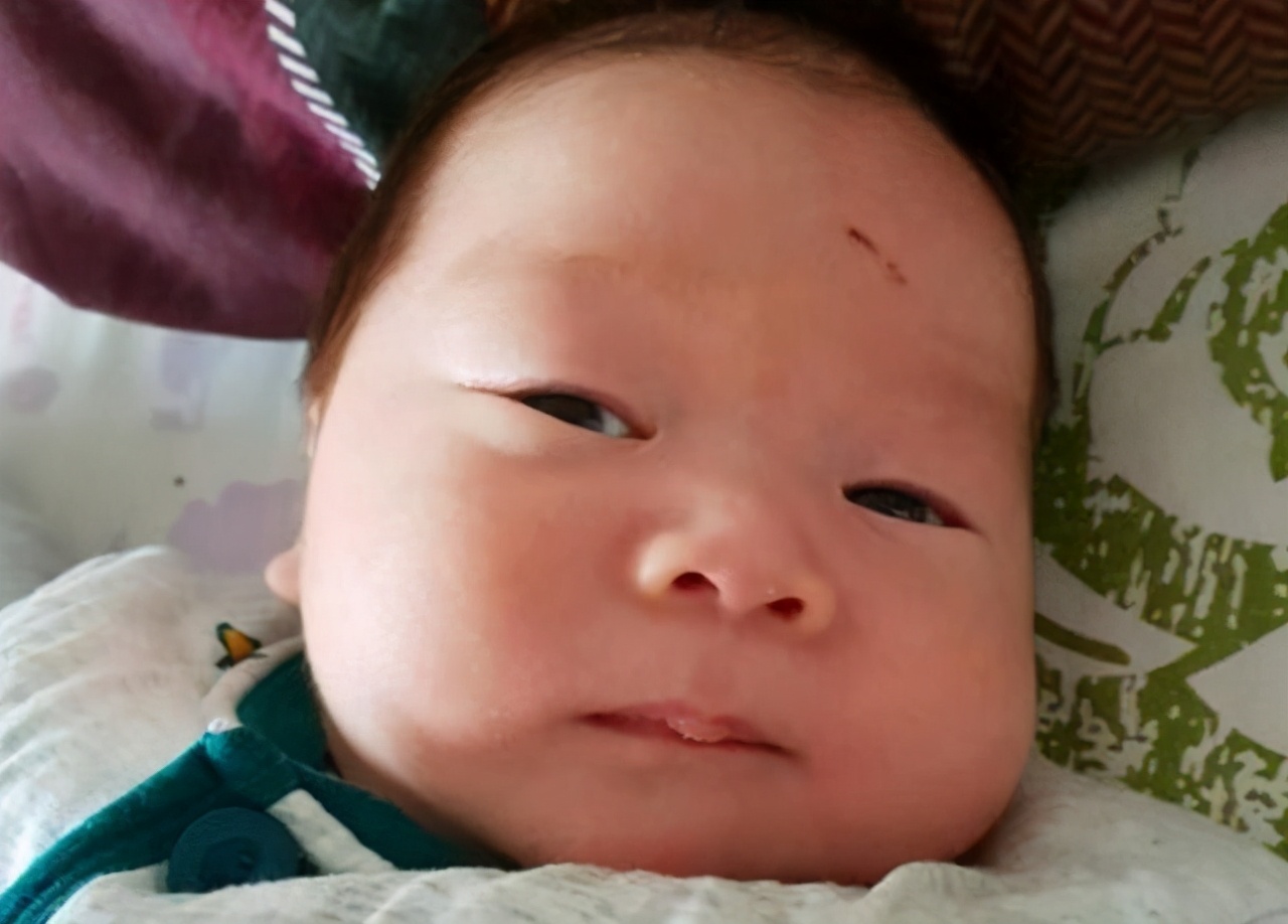 宝宝总是把自己挠破,宝宝老是挠破怎么办