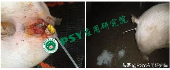 子宫炎有特效药吗,子宫炎治疗贵吗