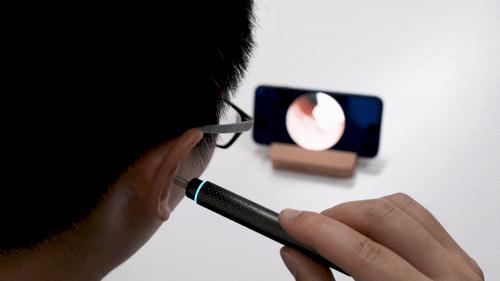 2岁宝宝掏出一长条耳屎,给宝宝掏出一堆耳屎