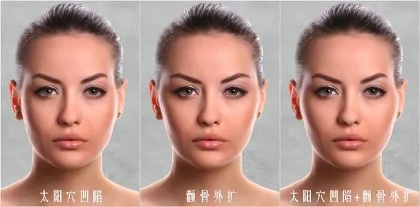 不对称脸型怎么改善,如何改善大小脸型