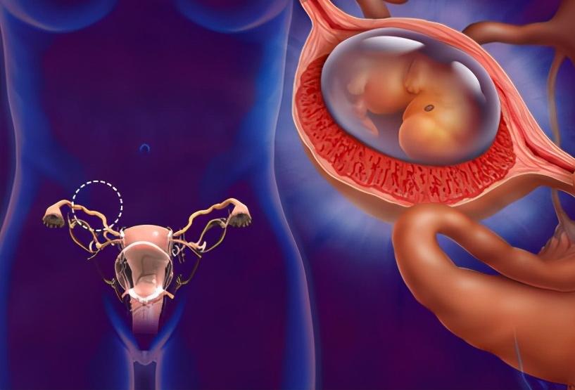 女性小腹痛警惕三种病,女性下腹隐痛要警惕四种病