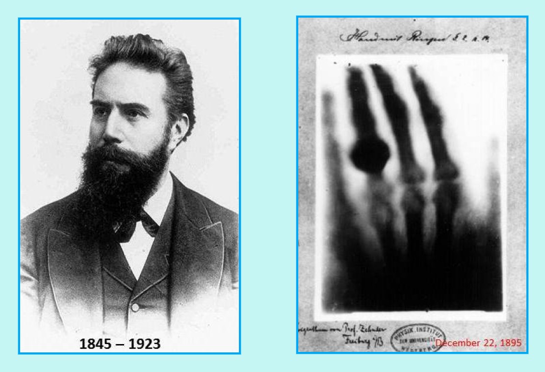 什么是X射线，它是如何被发现的，对人类有多大影响？