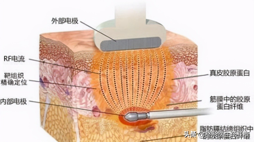 一次性说清,一次性说清要求