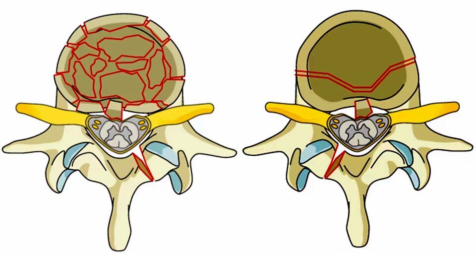 分秒必争救伤员,分秒必争的抢救