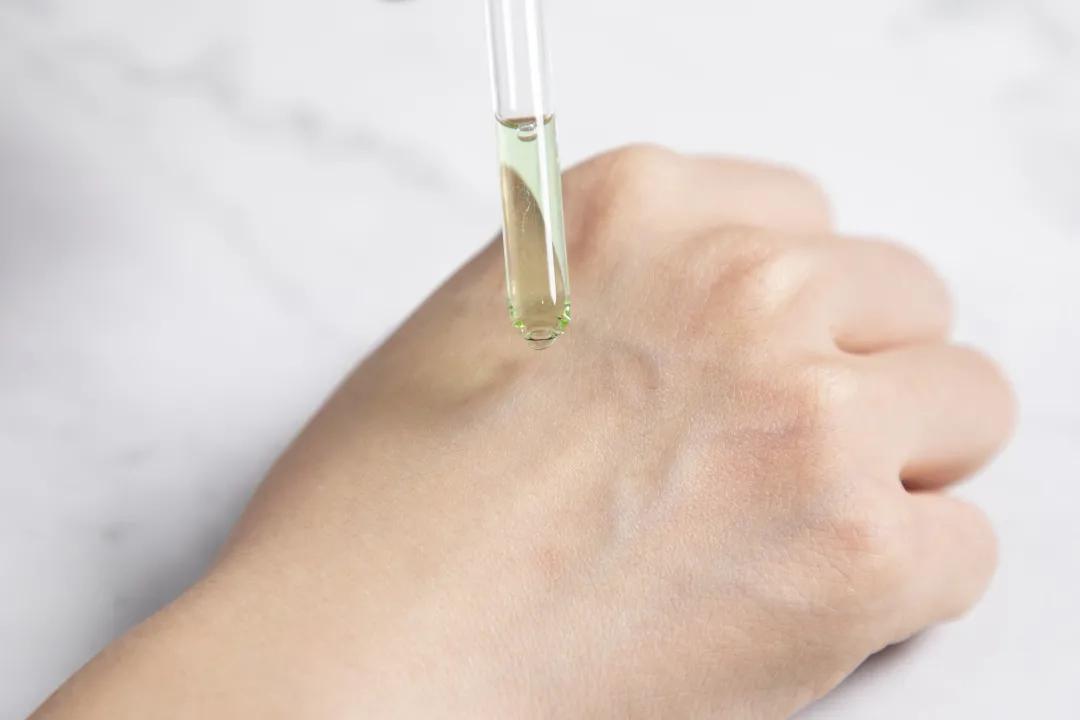 让无数姑娘无从下手的痘印，皮肤科医生有了解决新招