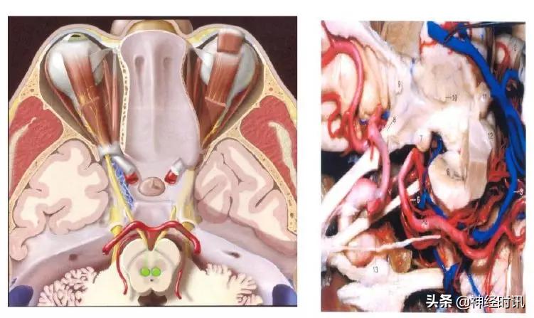 脑神经包含自主神经,脑神经算是传入神经吗