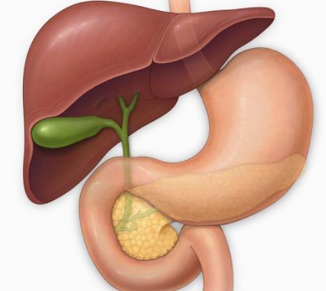 脂肪肝疏肝利胆药,胆结石脂肪肝寒湿怎么调理