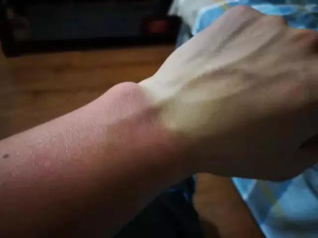 夏天骑行防晒小妙招,夏季骑行怎样防止手指晒黑