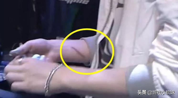 loltheshy细节,theshy手伤最新图片