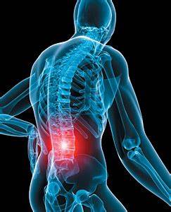 腰椎直的还能变弯么,腰椎生理弯曲变直和腰突哪个严重