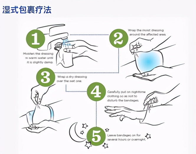 湿疹皮炎怎么治疗才能好,湿疹皮炎的最佳治疗方法