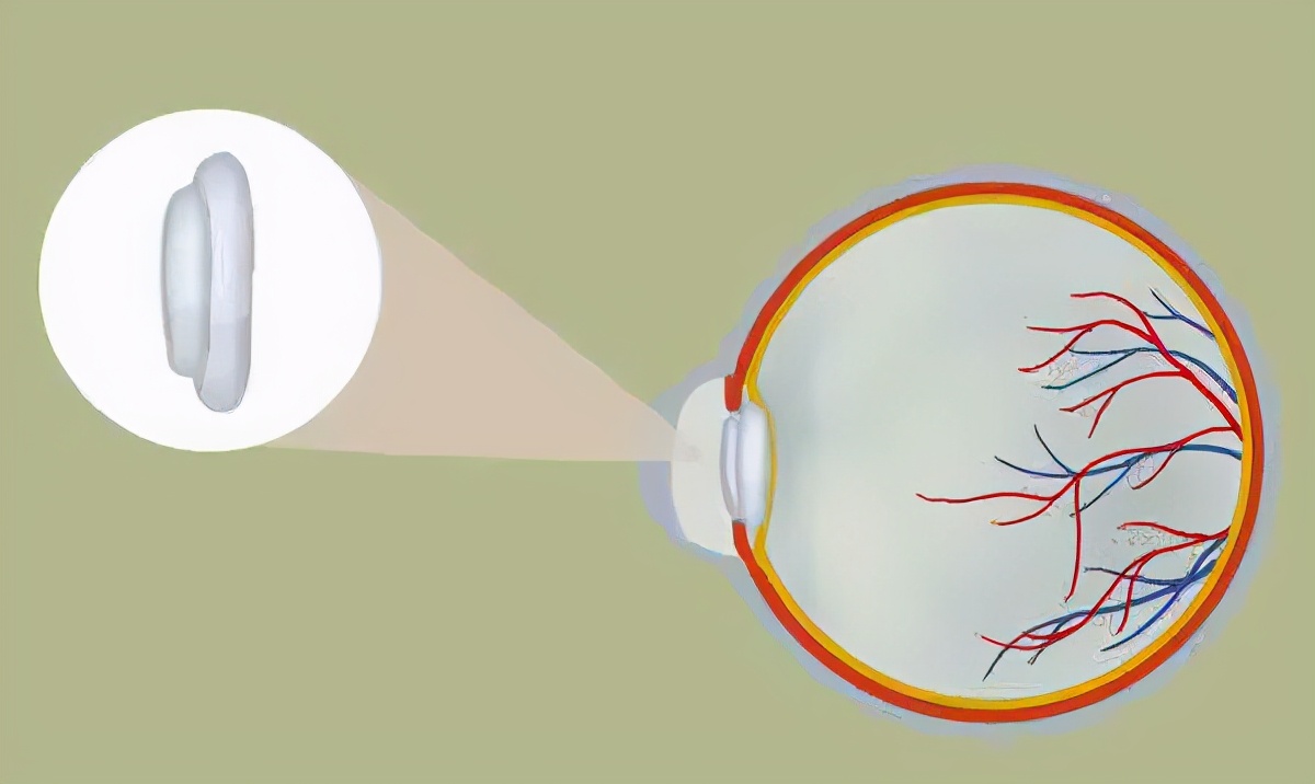 6岁孩子说眼睛痒眨眼怎么回事,小孩眼睛痒是有虫子吗