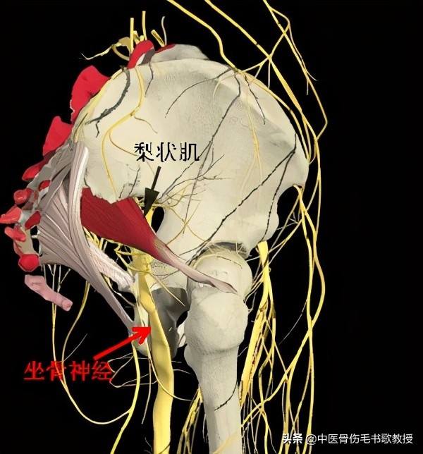 臀部、大腿后侧疼痛，坐骨神经痛，必备两种拉伸法，有效缓解疼痛