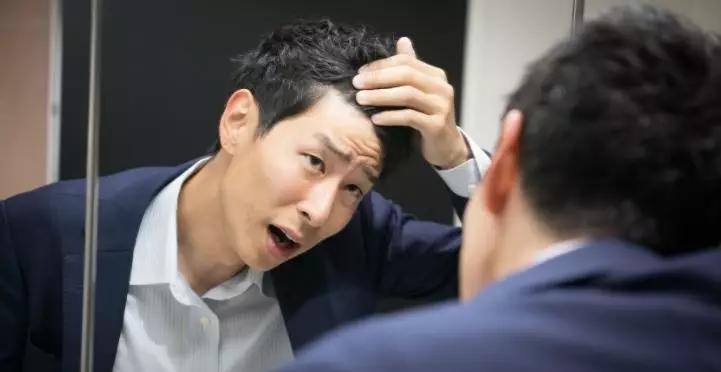 改善Ｍ型秃需要把重点放在细毛上！