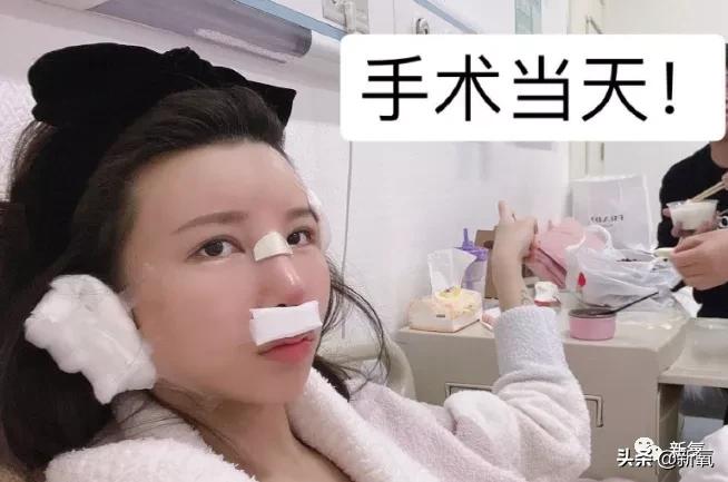 网红整鼻子整出坑,千万网红被坑