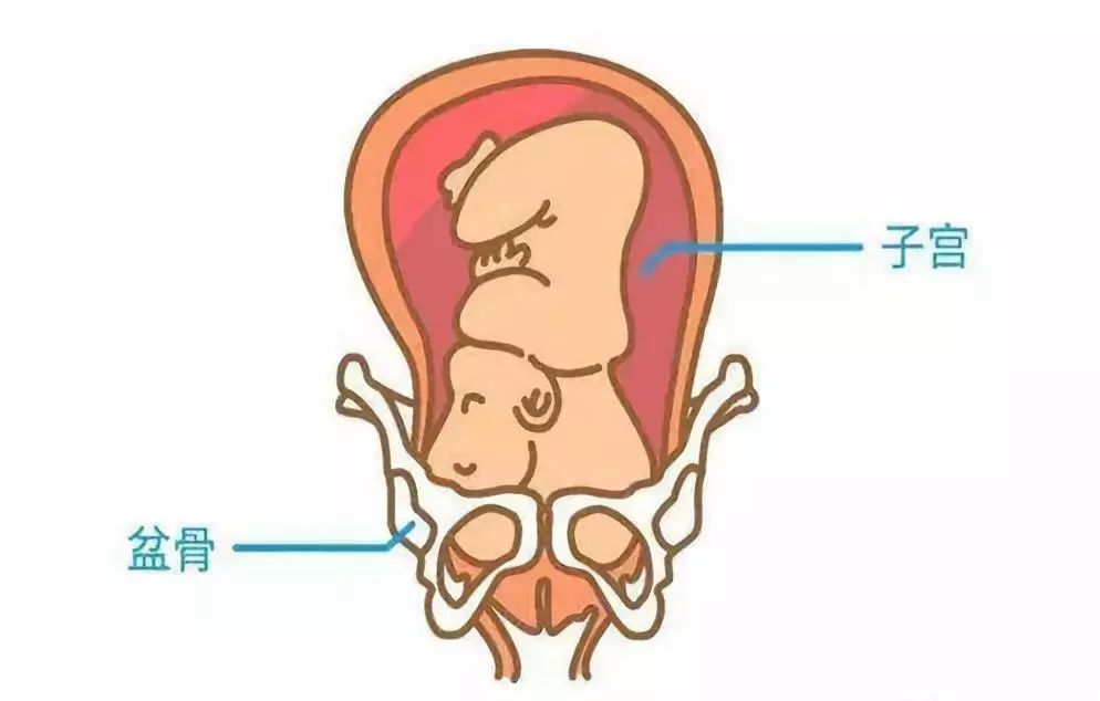 40周胎儿入盆不发动的原因,胎儿迟迟不入盆什么原因