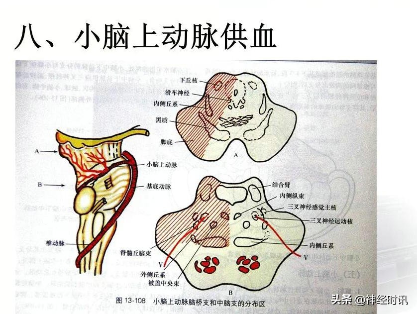 脑动脉解剖学讲解,基底节区脑血管解剖