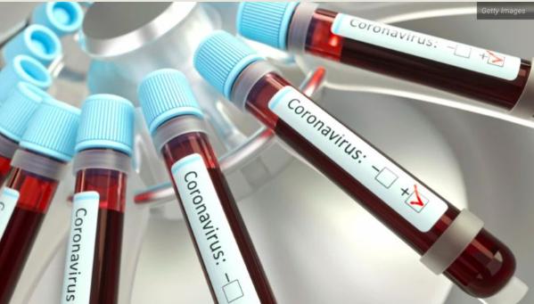 华裔病毒专家被杀一案详情,美籍华人研究病毒被杀