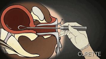 暑假变“人流假”，疯狂的不只成年人，还有12岁女学生