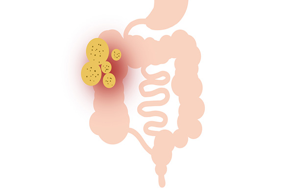 半个月没大便也没便意怎么办,半个月没有正常大便了什么情况