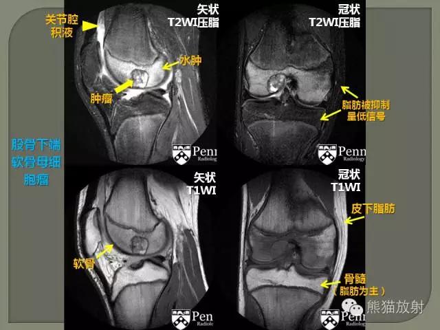 如何简单理解、认识MRI图像