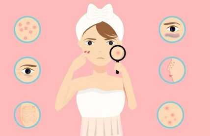 脸上有坑坑洼洼的痘印怎么消除,脸上坑坑洼洼女生