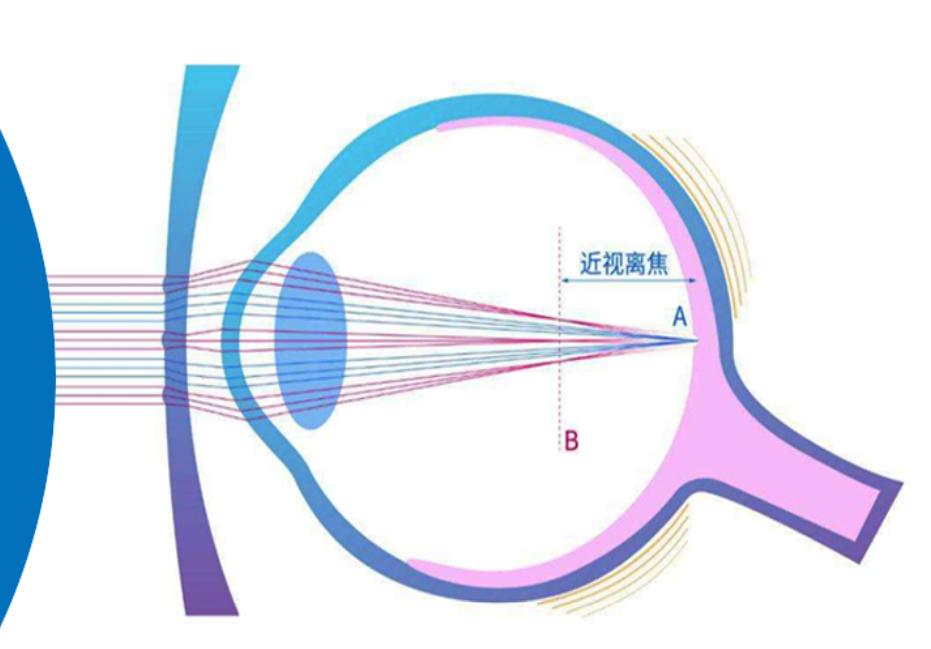 豪雅新乐学镜片最近配的还能用吗,如何保护豪雅新乐学镜片