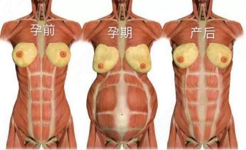 想从事产后修复行业该如何入手,妻子花7000做产康