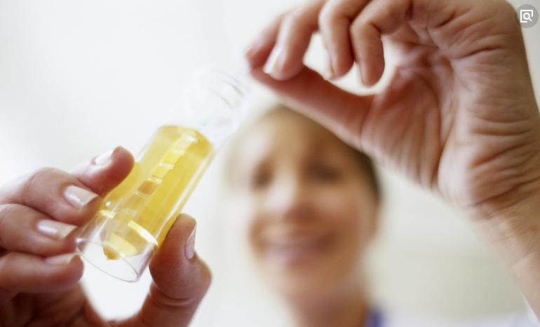 已婚女性反复尿路感染怎么办？该怎么治疗？全面解析来了