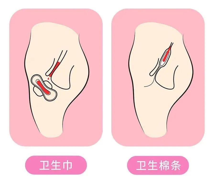 女生例假必备神器卫生巾,例假必备神器卫生巾