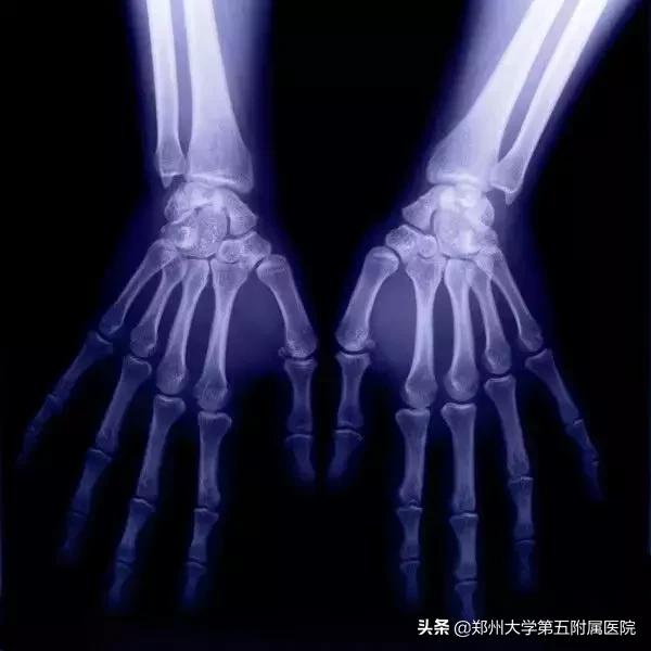 ct胶片的种类,ct胶片有利用价值吗